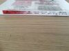 EV3 41060-01 Thrombus Management Cragg-McNamara Valved Infusion Catheter  5F x 135cm (X)