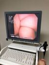 OLYMPUS ENF-V Rhinolaryngoscope
