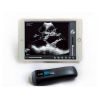 BETTER INSTRUMENT  Wireless ultrasound BSCAN-2