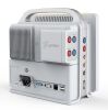 BETTER Modular Portable Multi Parameters Patient Monitor E8 Monitor