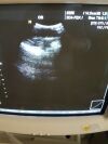 SAMSUNG-MEDISON 3D4-7EK Ultrasound Transducer