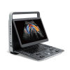 SONOSCAPE E2 Color Doppler E2