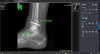 VIEWORKS Podiatry FXRD-1012NB DR