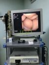 OLYMPUS GIF-N180 Gastroscope