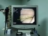 OLYMPUS GIF-XP150N Gastroscope