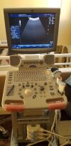 GE Logiq P5 Ultrasound - Shared Service