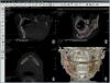 VATECH PAX-REVE 3D Dental X-Ray