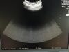 ZONARE C8-3 3D Ultrasound Transducer