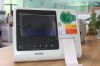 PHILIPS 861290  Philips HeartStart XL+ 861290 defibrillator spare parts in stocks  Defibrillator