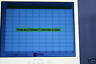KENSEY NASH Safe-Cross RF Shielding / Related