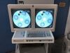 OEC 9600 ESP C-Arm
