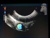 FUJINON EG530UT2 Gastroscope