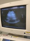 DIAGNOSTIC ULTRASOUND SSA-700A Toshiba Diagnostic Ultrasound System SSA-700A with SSA-770A Upgrade Kit