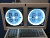 OEC 9600 ESP C-Arm
