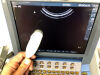 SONOSITE C11E Ultrasound Transducer