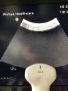 PHILIPS C6-2 Ultrasound Transducer