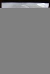 KCI M6275033 V.A.C. White Foam Small Dressing