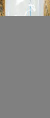 CORDIS CORP 534-543T Infiniti Thrulumen Diagnostic Catheter