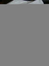 BOSTON SCIENTIFIC 390-201 Escape Nitinol Stone Retrieval Basket