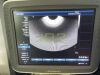 LANDWIND EC4-9/10E Ultrasound Transducer