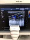 PHILIPS L8-4 Linear Probe for IE33 IU22 Ultrasound Transducer