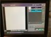 FUJI FCR Prima CR, IIP Workstation included CR