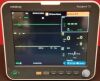 MINDRAY Passport 12 with EtCo2 Anesthesia Monitor