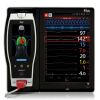 MASIMO Root Monitor