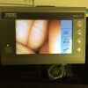 KARL STORZ 11301BNX with 8402ZX Intubation Scope