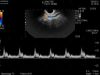 HITACHI C41V1 Ultrasound Transducer