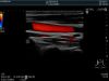 HITACHI L34 Ultrasound Transducer