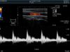 HITACHI L55 Ultrasound Transducer