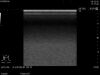 HITACHI L64 Ultrasound Transducer