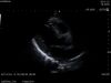 HITACHI S211 Ultrasound Transducer