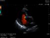 HITACHI S211 Ultrasound Transducer