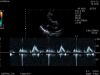 HITACHI S211 Ultrasound Transducer