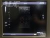 TOSHIBA PLT-1204AT Ultrasound Transducer