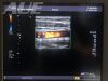 TOSHIBA PLT-1204AT Ultrasound Transducer