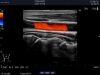 ALOKA UST-5419 Ultrasound Transducer