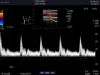 ALOKA UST-5419 Ultrasound Transducer