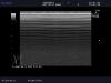 ALOKA UST-5710-7.5 Ultrasound Transducer