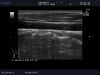 ALOKA UST-5710-7.5 Ultrasound Transducer