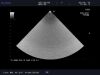ALOKA UST-52109 Ultrasound Transducer