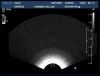 PHILIPS C8-4v Ultrasound Transducer