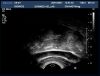 PHILIPS C8-4v Ultrasound Transducer