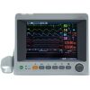 EDAN iM50 Multiparameter Monitor
