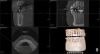 VATECH PAX I 3D with ONE SHOT CEP Dental X-Ray
