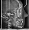 VATECH PAX I SC Dental X-Ray