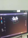 AKICARE Used original PVT-661VT for Toshiba Ultrasound Transducer