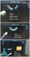 AKICARE Used broken RIC5-9-D for GE Ultrasound Transducer